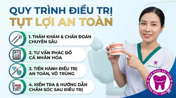 7 Cách chữa răng bị tụt lợi hiệu quả, an toàn chuẩn y khoa 9 Quy trình 4 bước điều trị tụt lợi an toàn tại Nha khoa Sài Gòn Phong Phú