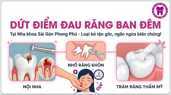 7+ Cách trị nhức răng ban đêm tại nhà hiệu quả tức thì 12 Nha khoa Sài Gòn Phong Phú - Đơn vị giúp bạn loại bỏ tận gốc nguyên nhân từ các cơn đau răng