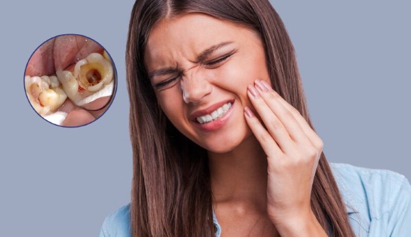 7+ Cách trị nhức răng ban đêm tại nhà hiệu quả tức thì 2 Những nguyên nhân phổ biến gây nhức răng ban đêm
