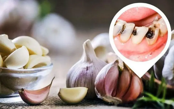 7+ Cách trị nhức răng ban đêm tại nhà hiệu quả tức thì 8 Nhai lá ổi hoặc tỏi là cách trị nhức răng ban đêm tiện lợi và hiệu quả