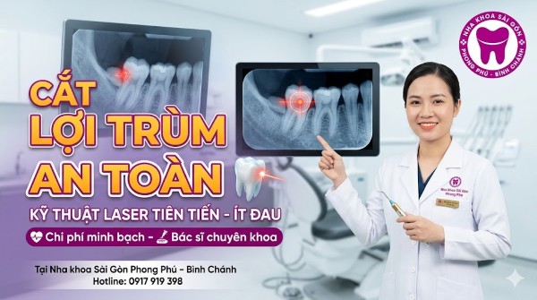 Cắt lợi trùm là gì? Bảng giá và lưu ý quan trọng từ Bác sĩ 7 Nha khoa Sài Gòn Phong Phú – Bình Chánh đơn vị được nhiều khách hàng tin tưởng