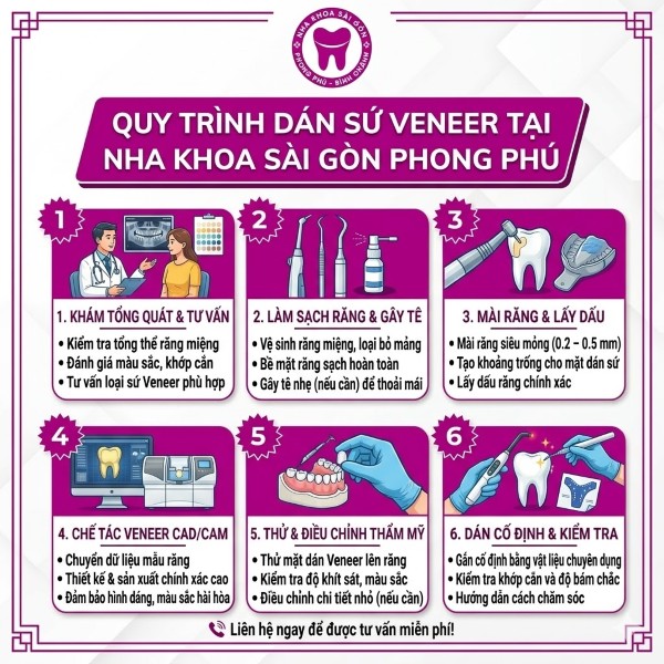 Dán sứ veneer có bền không? Nhận định từ Bác sĩ nha khoa 4 Quy trình dán sứ Veneer chuẩn y khoa tại Nha khoa Sài Gòn Phong Phú