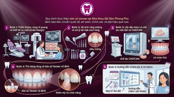 Dán sứ Veneer là gì? Ưu nhược điểm, chi phí & quy trình chuẩn 5 Các bước thực hiện dán sứ Veneer tại Nha khoa Sài Gòn Phong Phú