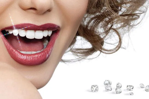 Đính đá răng là gì? Quy trình thẩm mỹ an toàn & bảng giá 1 Đính đá răng là kỹ thuật nha khoa thẩm mỹ sử dụng các loại đá quý