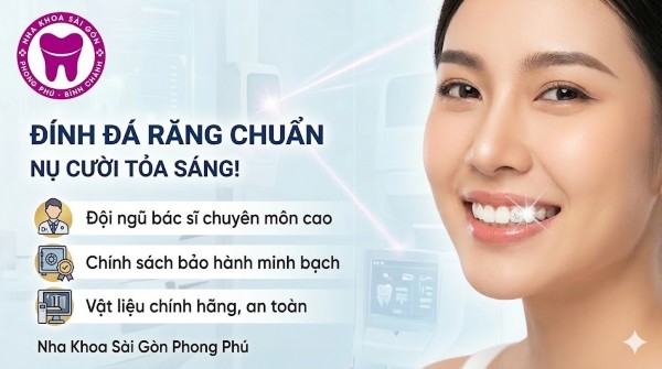 Đính đá răng là gì? Quy trình thẩm mỹ an toàn & bảng giá 8 Nha khoa Sài Gòn Phong Phú - Đơn vị cung cấp dịch vụ đính đá răng chất lượng và đáng tin cậy