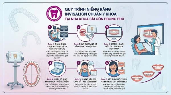 Giá niềng răng Invisalign bao nhiêu? Bảng giá mới nhất 2026 3 Quy trình 6 bước niềng răng Invisalign chuẩn Y khoa tại Sài Gòn Phong Phú