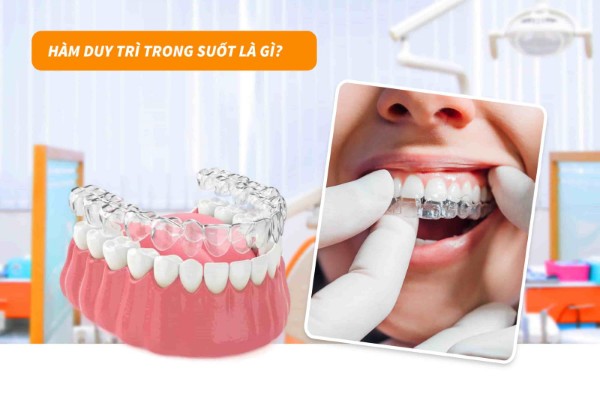 Hàm duy trì trong suốt: Ưu điểm, Bảng giá & Lưu ý khi dùng 1 Hàm duy trì trong suốt