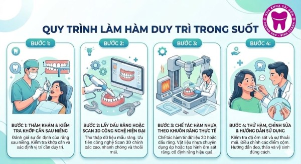 Hàm duy trì trong suốt: Ưu điểm, Bảng giá & Lưu ý khi dùng 7 Quy trình 4 bước làm hàm duy trì trong suốt tại Nha Khoa Sài Gòn Phong Phú