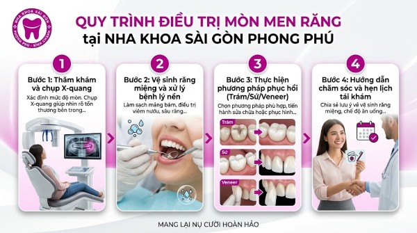 Mòn men răng: Nguyên nhân, dấu hiệu và cách điều trị hiệu quả 10 Quy trình 4 bước điều trị mòn men răng tại Nha khoa Sài Gòn Phong Phú