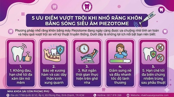 Nhổ răng khôn bằng máy Piezotome: Không đau, nhanh lành 2 5 Ưu điểm vượt trội khi nhổ răng khôn bằng sóng siêu âm Piezotome