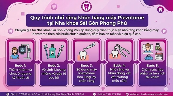 Nhổ răng khôn bằng máy Piezotome: Không đau, nhanh lành 3 Quy trình 5 bước nhổ răng khôn bằng máy Piezotome tại Nha khoa Sài Gòn Phong Phú