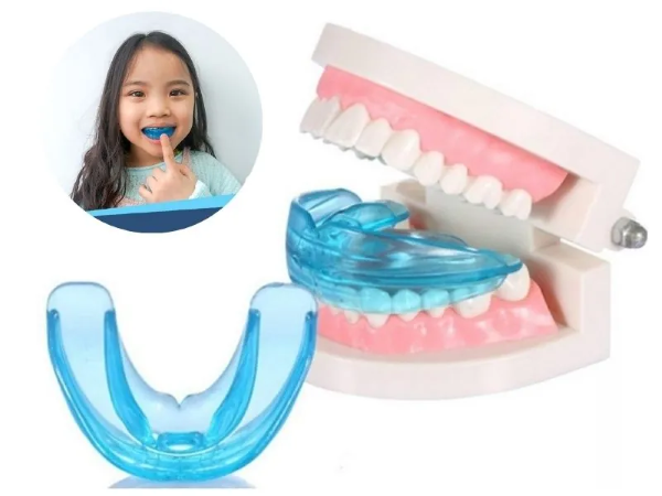 Niềng răng trẻ em: Cẩm nang từ A-Z giúp bé có nụ cười đẹp 5 Niềng răng trẻ em bằng khí cụ tháo lắp và hàm tiền chỉnh nha Silicon