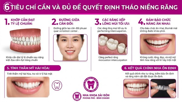 Tháo niềng răng: Quy trình thực hiện và những lưu ý quan trọng 2 6 tiêu chí ảnh hưởng đến quyết định tháo niềng răng