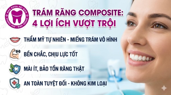 Trám răng Composite là gì? Bảng giá mới nhất tại Nha khoa 2 Phương pháp trám răng composite mang lại nhiều lợi ích vượt trội