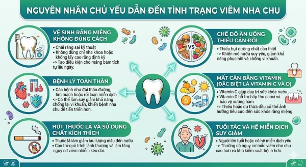 Viêm nha chu là gì? Nguyên nhân, dấu hiệu và cách điều trị 5 Các nguyên nhân chủ yếu dẫn đến tình trạng viêm nha chu