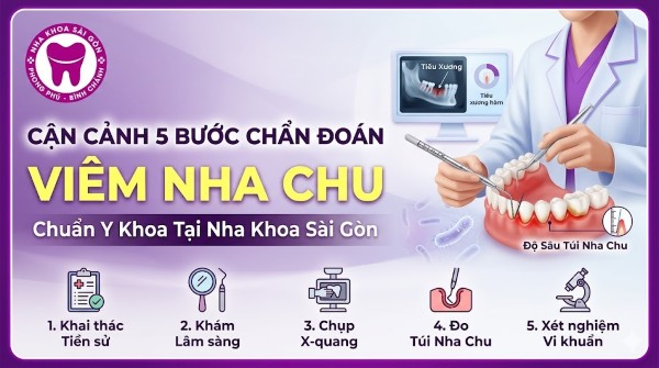 Viêm nha chu là gì? Nguyên nhân, dấu hiệu và cách điều trị 6 Quy trình chẩn đoán viêm nha chu tại phòng khám