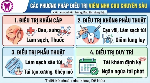 Viêm nha chu là gì? Nguyên nhân, dấu hiệu và cách điều trị 7 Các phương pháp điều trị viêm nha chu phù hợp nhằm kiểm soát nhiễm trùng