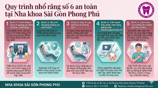 Nhổ răng số 6 giá bao nhiêu? Bảng giá mới nhất 2026 4 5 bước nhổ răng số 6 an toàn tại Nha khoa Sài Gòn Phong Phú
