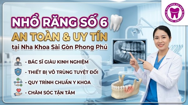 Nhổ răng số 6 giá bao nhiêu? Bảng giá mới nhất 2026 6 Nha khoa Sài Gòn Phong Phú - Đơn vị uy tín được nhiều khách hàng tin tưởng lựa chọn