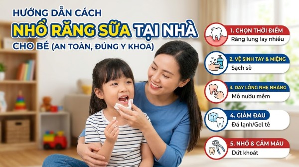 Cách nhổ răng sữa cho bé tại nhà an toàn, không đau, ít chảy máu 3 Cách nhổ răng sữa cho bé tại nhà an toàn, đúng chuẩn y khoa