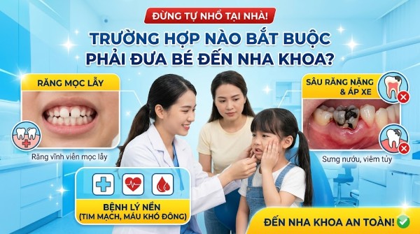 Cách nhổ răng sữa cho bé tại nhà an toàn, không đau, ít chảy máu 4 Một số trường hợp cần đưa trẻ đến nha khoa thăm khám và nhổ răng sữa
