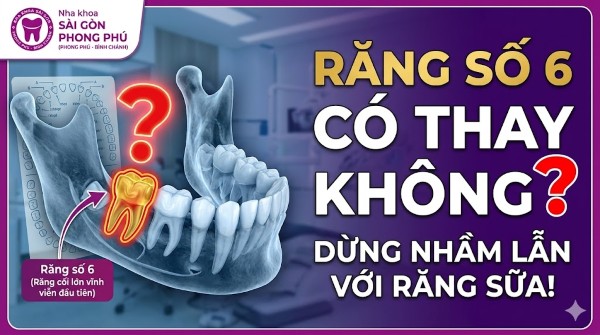 Răng số 6 có thay không? Giải đáp từ chuyên gia Nha khoa 2 Giải đáp: Răng số 6 có thay không?