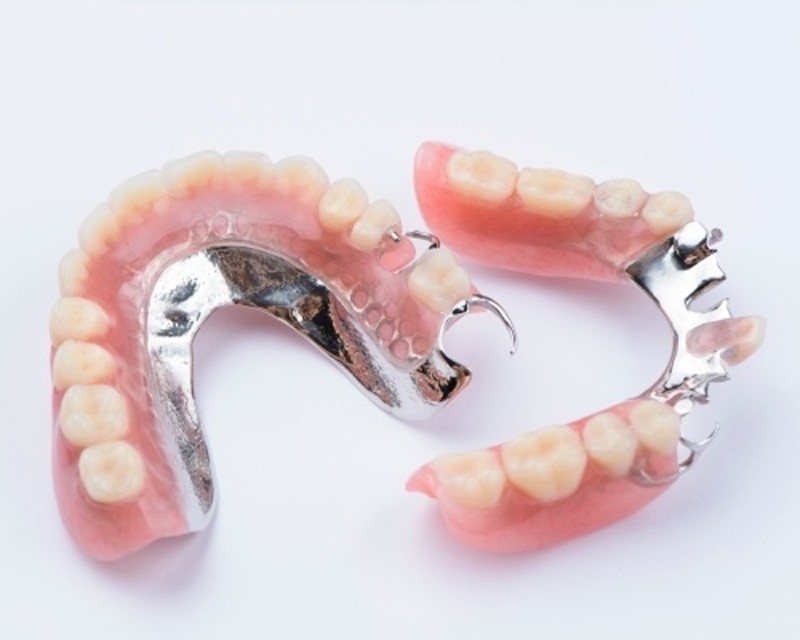 Hàm khung tháo lắp là gì? Ưu nhược điểm & Bảng giá mới nhất 3 Hàm khung hợp kim Cr-Co