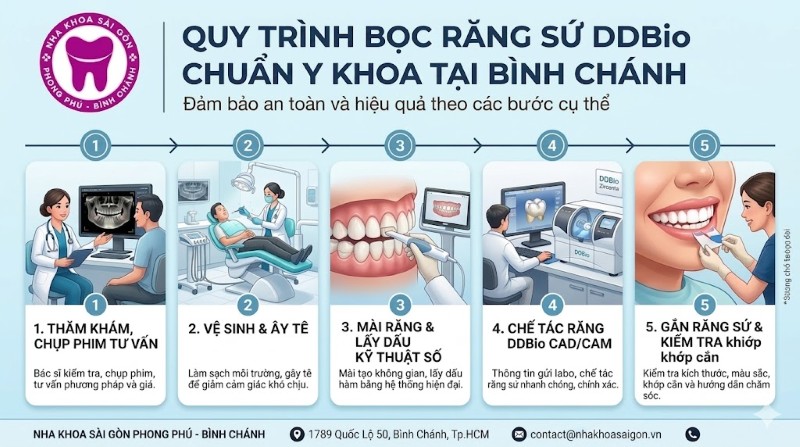 Răng toàn sứ DDBio là gì? Ưu điểm, bảng giá và lưu ý quan trọng 4 Quy trình bọc răng sứ DDBio chuẩn Y khoa tại nha khoa Sài gòn Phong Phú
