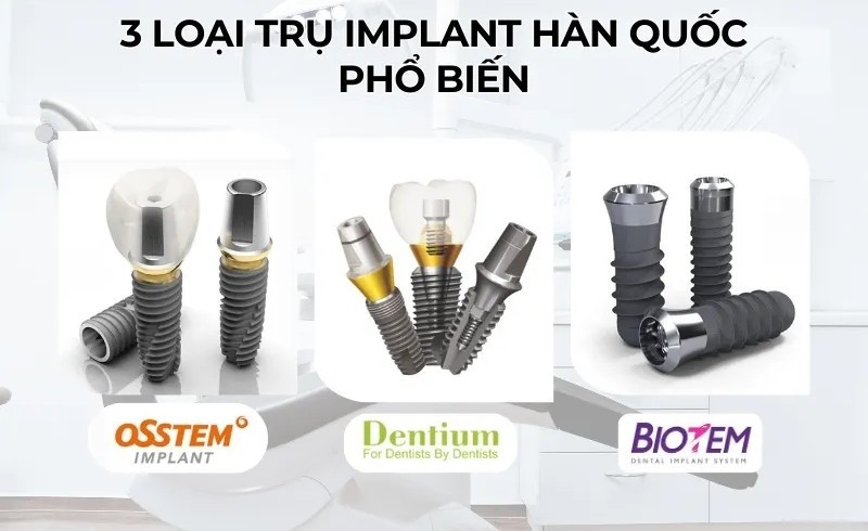 Trồng răng Implant có nguy hiểm không? Cách tránh biến chứng 8 Trụ implant chính hãng Biotem, Osstem, Dentium