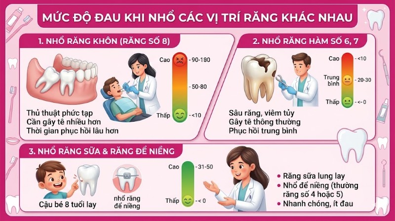 Nhổ răng có đau không? Sự thật và những lưu ý để không đau 3 Mức độ đau khi nhổ các vị trí răng khác nhau