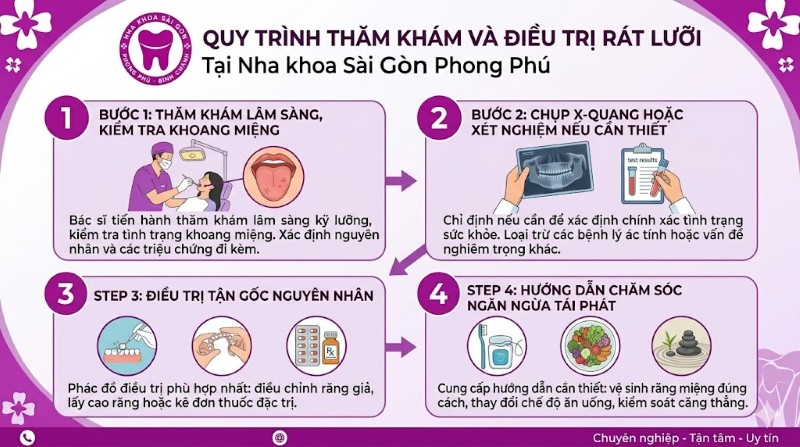 Rát lưỡi là bệnh gì? Nguyên nhân, dấu hiệu và cách điều trị 9 Quy trình 4 bước thăm khám và điều trị rát lưỡi tại Nha khoa Sài Gòn Phong Phú