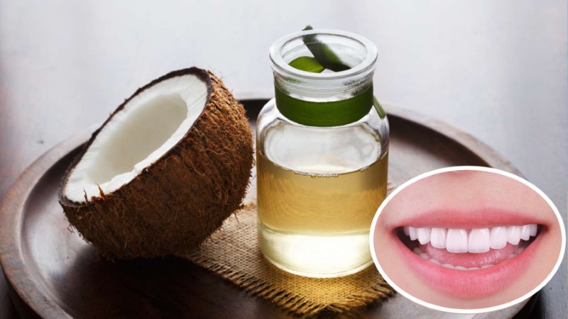 Súc miệng bằng dầu dừa: Tác dụng, cách làm và lưu ý y khoa 1 Phương pháp súc miệng bằng dầu dừa