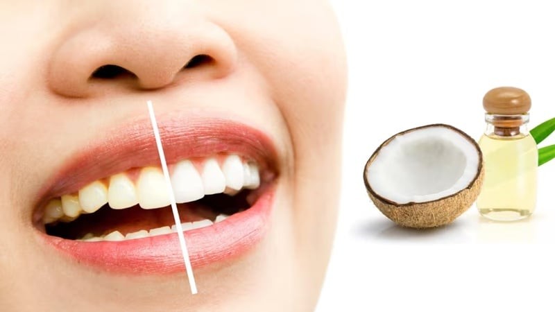 Súc miệng bằng dầu dừa: Tác dụng, cách làm và lưu ý y khoa 5 Súc miệng bằng dầu dừa giúp làm trắng răng một cách tự nhiên
