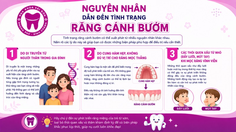 Răng cánh bướm: Nguyên nhân, tác hại và giải pháp từ bác sĩ 2 3 Nguyên nhân chính dẫn đến tình trạng răng cánh bướm
