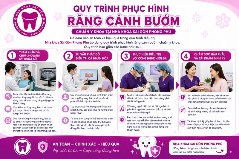 Răng cánh bướm: Nguyên nhân, tác hại và giải pháp từ bác sĩ 7 Quy trình phục hình răng cánh bướm chuẩn y khoa