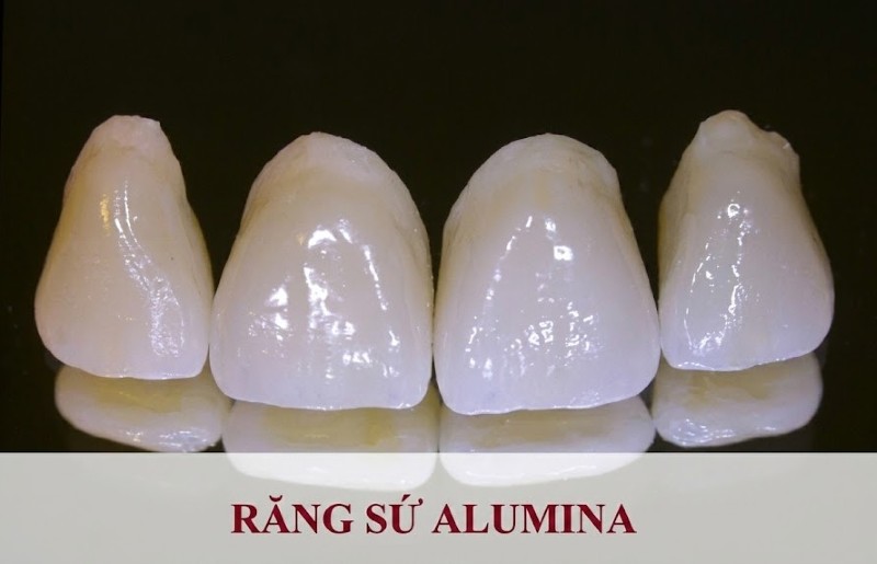 Răng sứ Alumina có tốt không? Ưu nhược điểm và giá bọc sứ 1 Răng sứ Alumina là một loại răng được làm từ vật liệu sứ Alumina