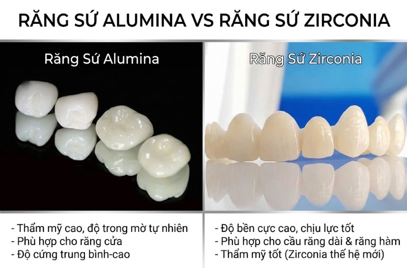 Răng sứ Alumina có tốt không? Ưu nhược điểm và giá bọc sứ 3 So sánh răng sứ Alumina và răng sứ Zirconia
