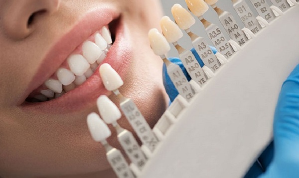 Bọc răng sứ trả góp 0% lãi suất tại Nha khoa Sài Gòn Phong Phú 2 Lợi ích thiết thực khi chọn phương thức làm răng trả góp