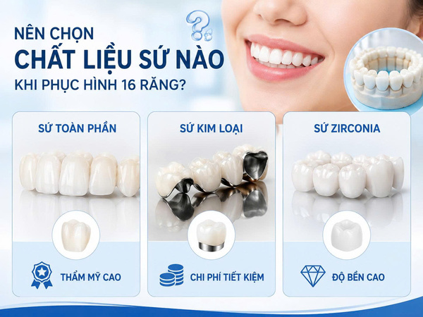 Bọc sứ 16 răng toàn hàm giá bao nhiêu tiền hiện nay? 3 Nên chọn chất liệu sứ nào khi phục hình 16 răng?