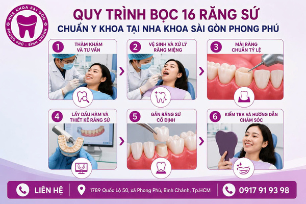 Bọc sứ 16 răng toàn hàm giá bao nhiêu tiền hiện nay? 4 Quy trình bọc 16 răng sứ chuẩn y khoa tại Nha khoa Sài Gòn Phong Phú