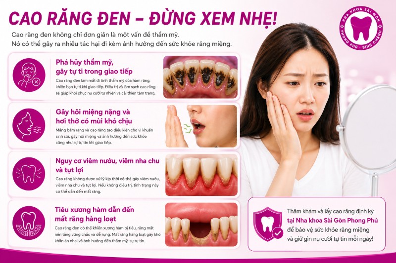 Cao răng đen: Nguyên nhân, tác hại và cách điều trị triệt để 5 4 nguy cơ tiềm ẩn đến từ tình trạng cao răng đen khi không điều trị kịp thời