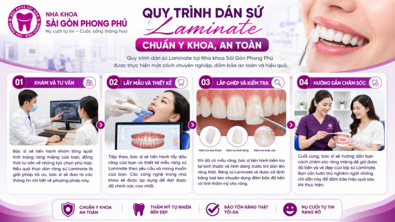 Dán răng sứ Laminate siêu mỏng, ít mài và bảng giá 3 Quy trình 44 bước dán sứ Laminate chuẩn y khoa tại Nha khoa Sài Gòn Phong Phú