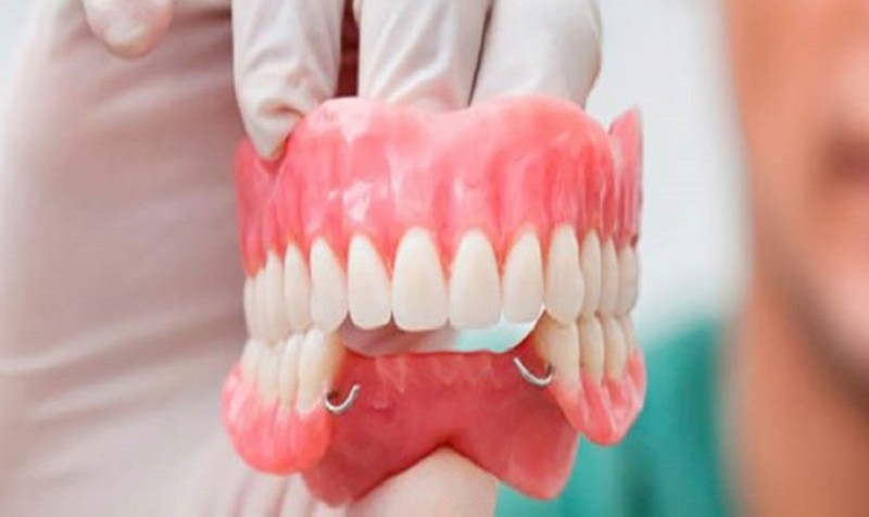 Hàm khung là gì? Ưu điểm, cách dùng và những điều cần lưu ý 5 Ưu và nhược điểm khi sử dụng hàm khung tháo lắp