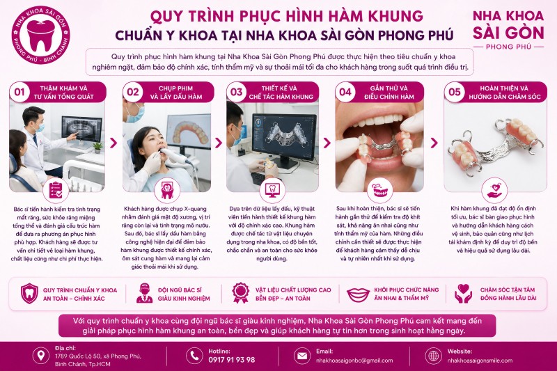 Hàm khung là gì? Ưu điểm, cách dùng và những điều cần lưu ý 6 5 bước phục hình hàm khung chuẩn y khoa tại Nha Khoa Sài Gòn Phong Phú