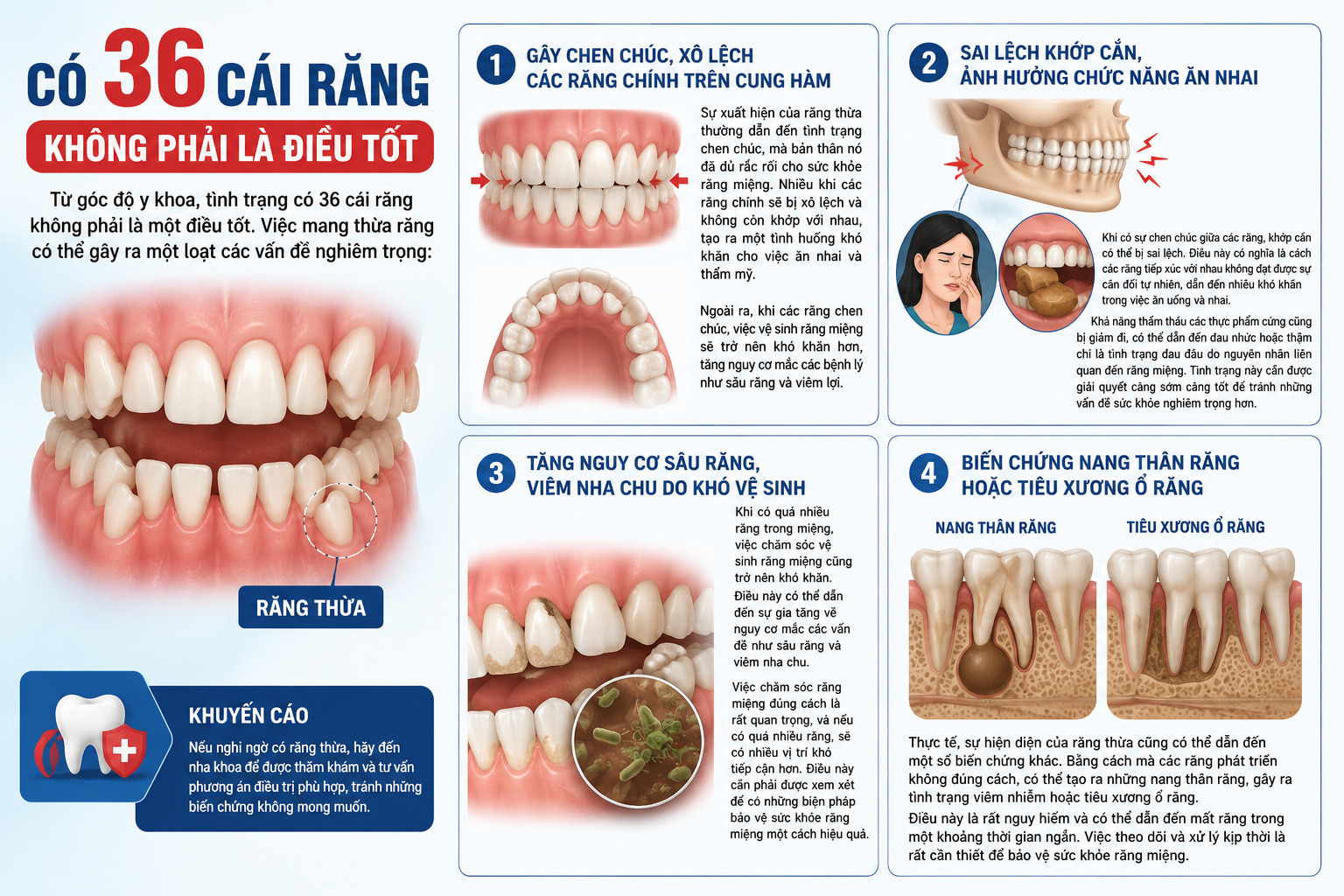 Người có 36 cái răng thì sao? Tốt hay Xấu dưới góc độ Y khoa? 4 Người có 36 cái răng thì sao? 4 vấn đề của 36 chiếc răng mang lại