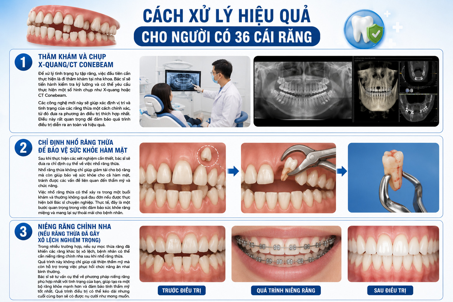 Người có 36 cái răng thì sao? Tốt hay Xấu dưới góc độ Y khoa? 5 3 phương pháp xử lý hiệu quả cho người có 36 cái răng