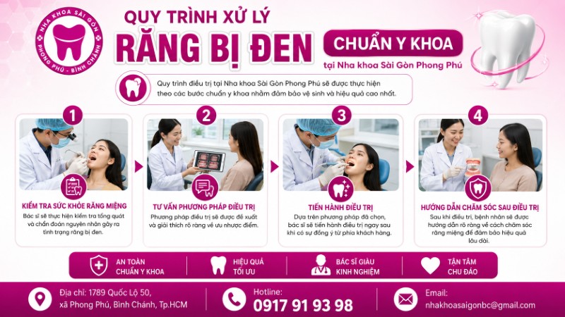 Răng bị đen trên bề mặt là gì? Nguyên nhân & cách xử lý hiệu quả 6 Quy trình xử lý răng bị đen chuẩn y khoa tại Nha khoa Sài Gòn Phong Phú