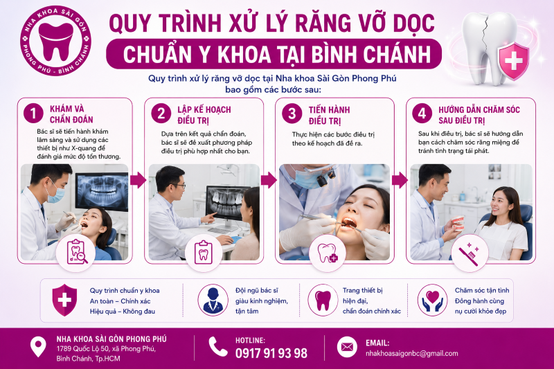Răng bị vỡ dọc: Nguyên nhân, dấu hiệu và cách xử lý dứt điểm 5 Quy trình xử lý răng vỡ dọc chuẩn y khoa tại Nha khoa Sài Gòn Phong Phú