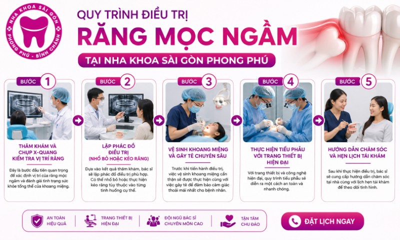 Răng mọc ngầm: Dấu hiệu, nguy hiểm và cách điều trị hiệu quả 4 Quy trình điều trị răng mọc ngầm tại Nha khoa Sài Gòn Phong Phú