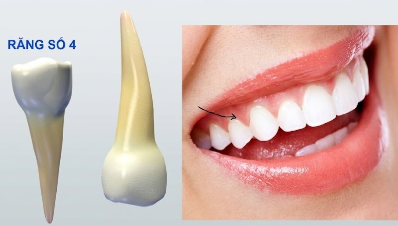 Răng số 4 là răng gì? Vị trí, chức năng và những lưu ý quan trọng 2 Răng số 4 thường có từ một đến hai chân